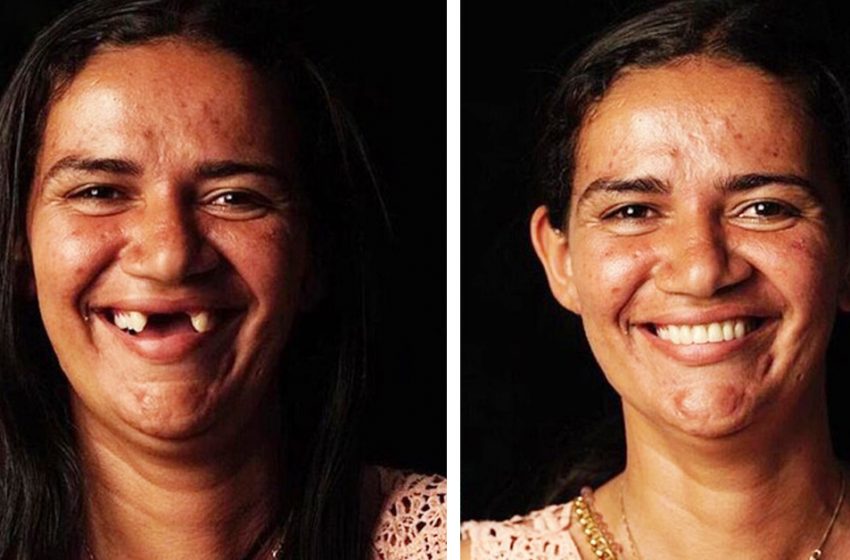  Un dentiste brésilien aide les pauvres à mieux briller
