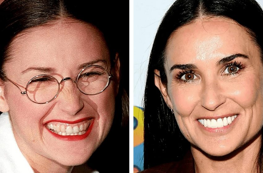  Combien les dents ont changé le portrait des célébrités : 10 transformations de célébrités