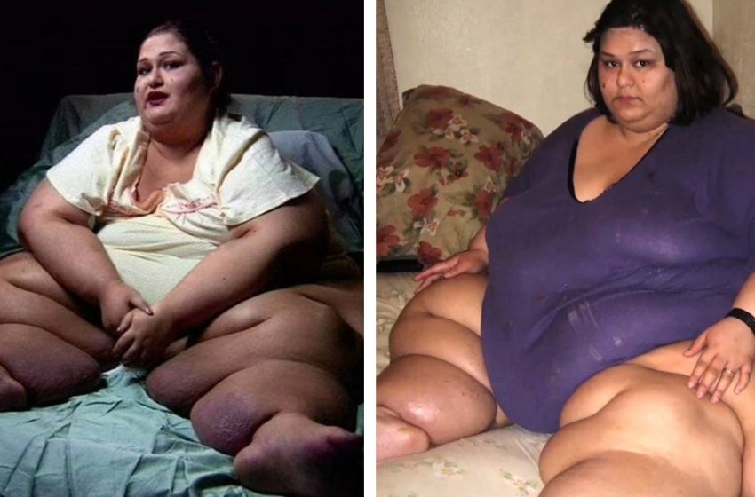  “Elle occupait tout un lit double”: A quoi ressemble aujourd’hui la femme qui a perdu 360 kg ?
