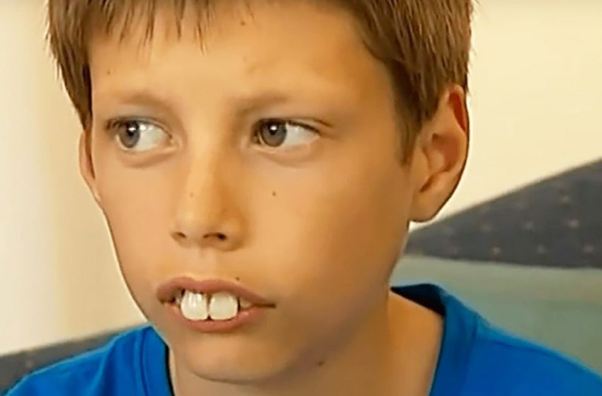  Qu’est-il arrivé au garçon dont les dents ont été surnommées les plus grandes du monde ?