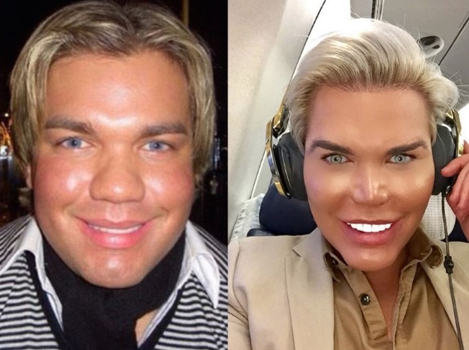 Before, he was a handsome boy. What 'live Ken' Rodrigo Alves looked ...