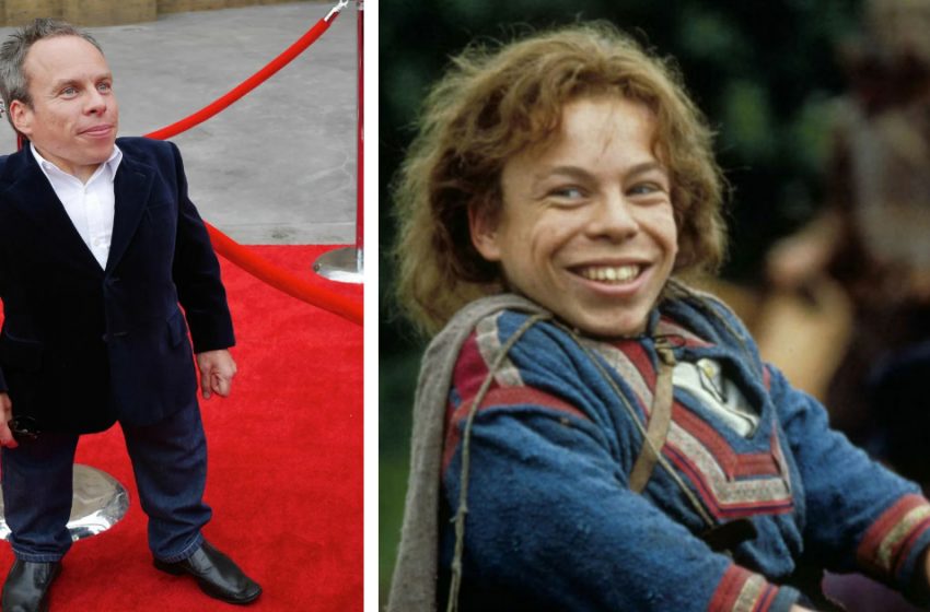  A quoi ressemblent les enfants de la star de “Harry Potter”, qui ont hérité de la particularité de leur père, qui mesure 107 cm.